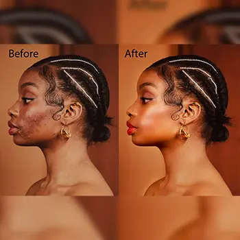 Image-Manipulation
